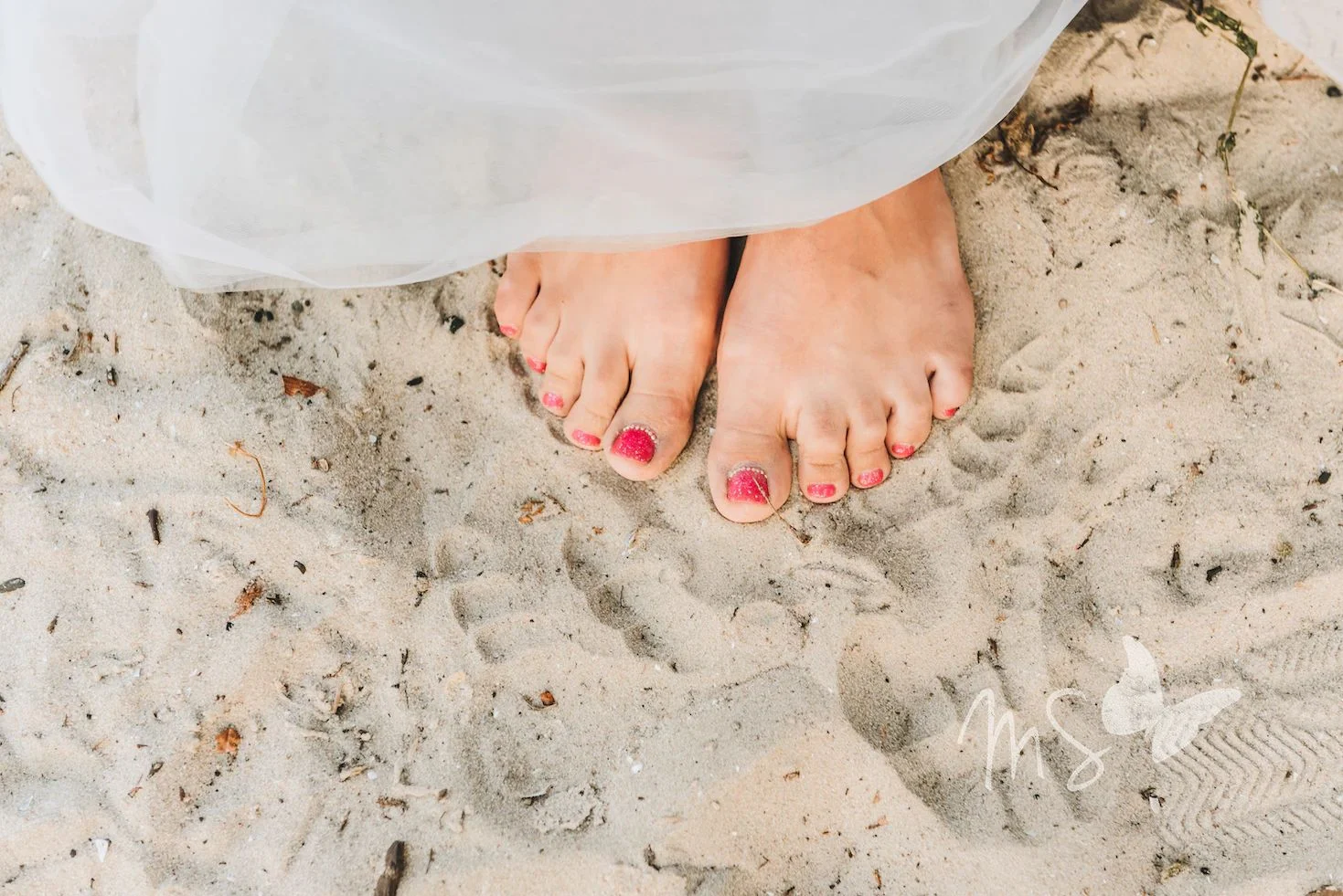 Las vacaciones en la playa pueden ser una ola abrumadora…